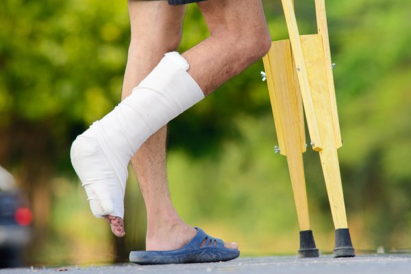 Реабилитация после переломов и травм – важно учитывать множество факторов